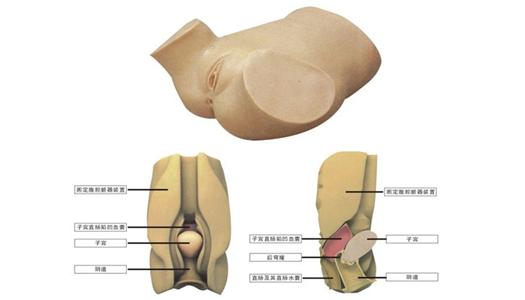 阴道后穹窿穿刺术模型